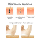 Depilador Láser Ipl