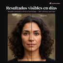 SkinLift 3X™ Sistema de Renovación Facial Antiarrugas